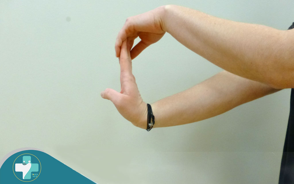 تمرین کشیدن مچ دست در فیزیوتراپی عصب دست 