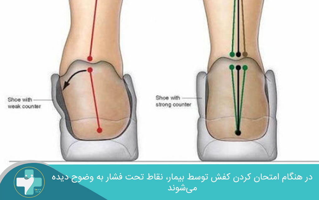 مراحل ساخت کفش طبی 