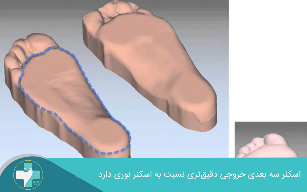 خروجی دقیق تر اسکن سه بعدی در اسکن کف پا 