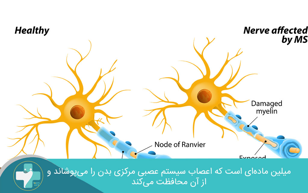 میلین در فیزیوتراپی ام اس 