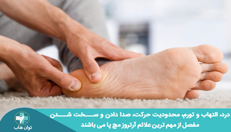 علائم-آرتروز-مچ-پا