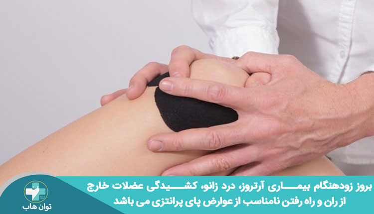 عوارض پای پرانتزی در بزرگسالی