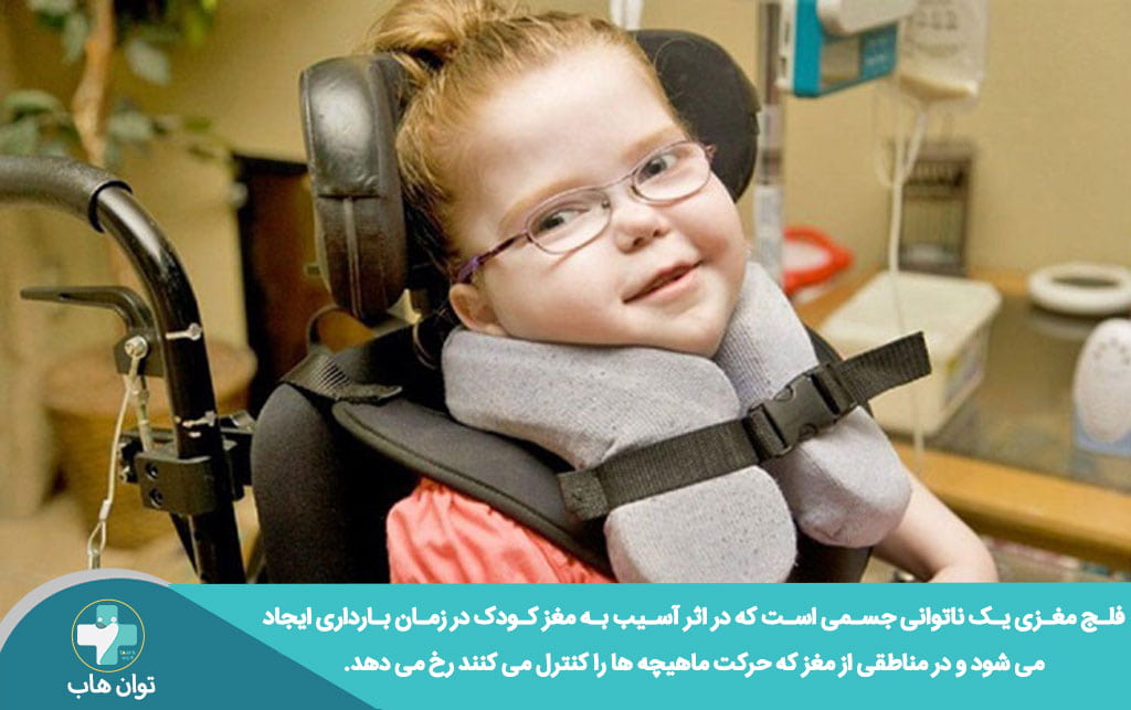 فلج مغزی