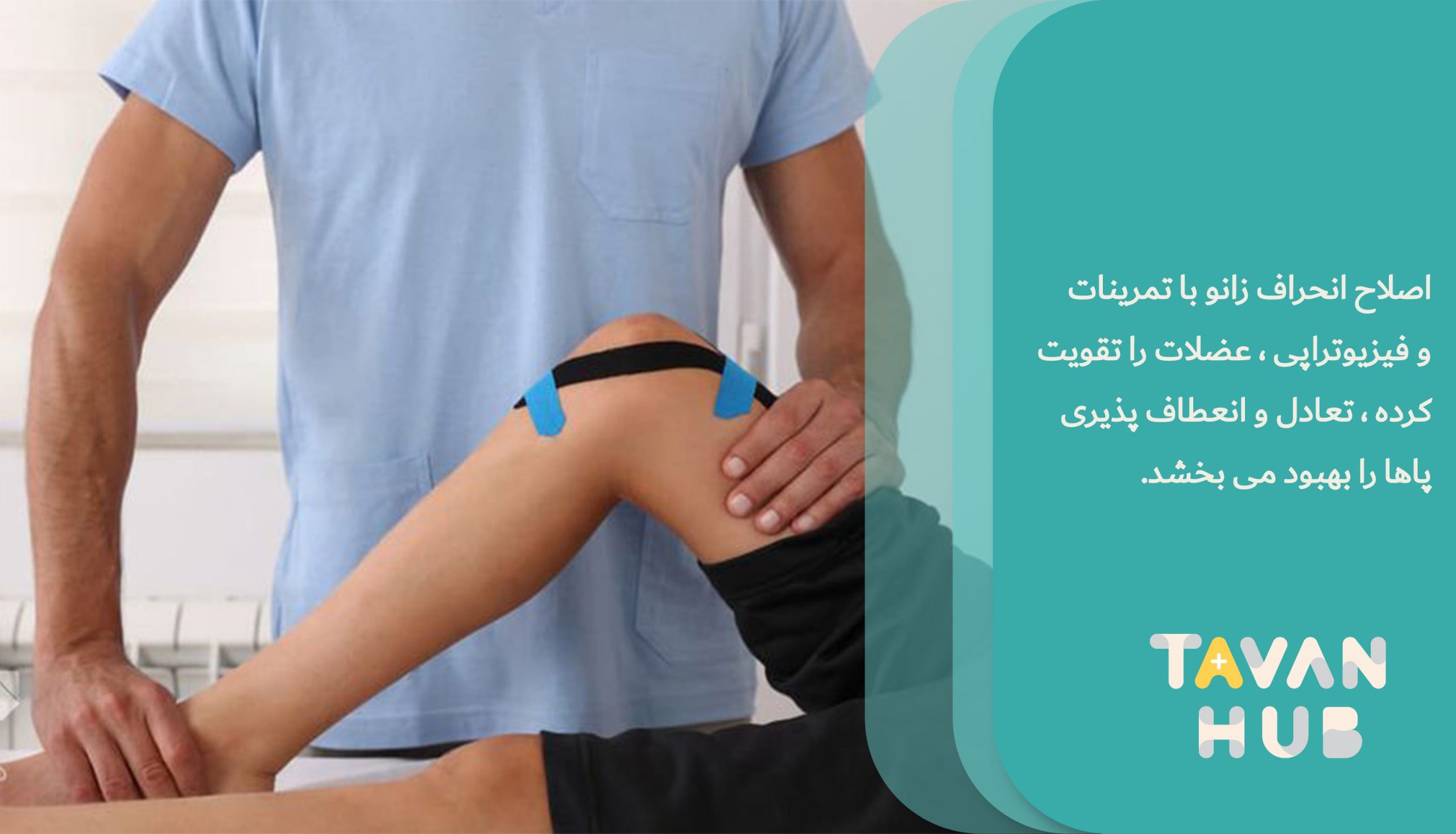 اصلاح انحراف زانو با فیزیوتراپی