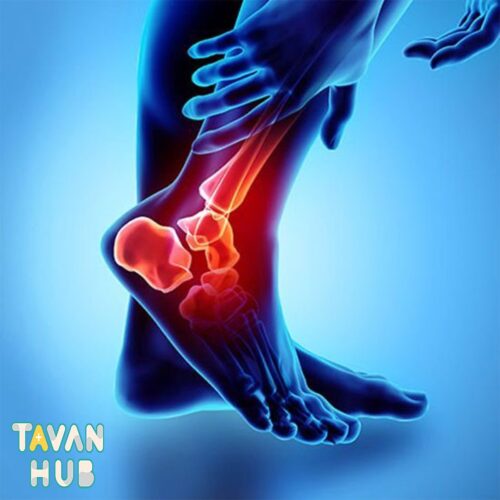 فیزیوتراپی کف پا