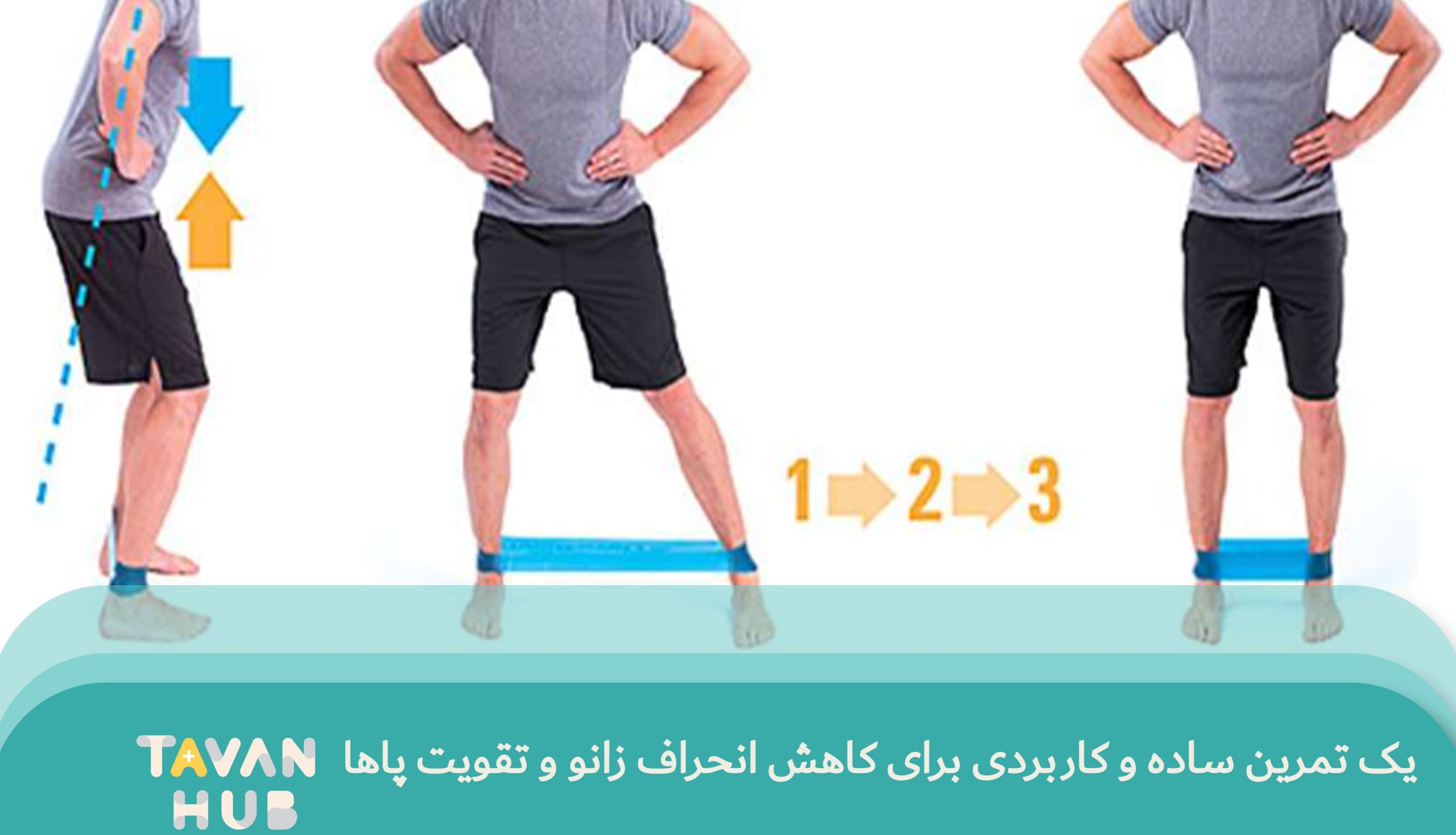 تمرین ساده برای اصلاح انحراف زانو